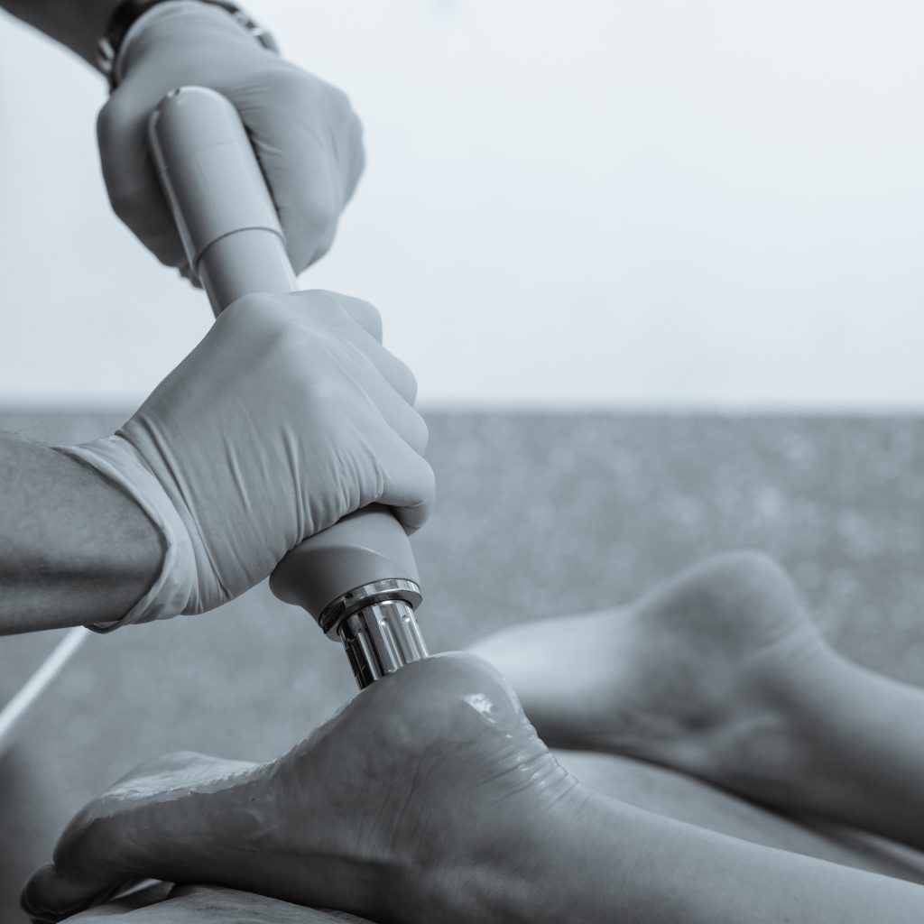 shockwave therapy foot treatment in fareham